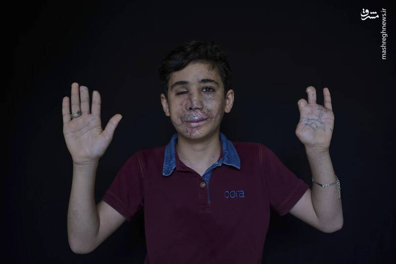 قصص غير مكتملة لضحايا قنابل جهاز البيجر