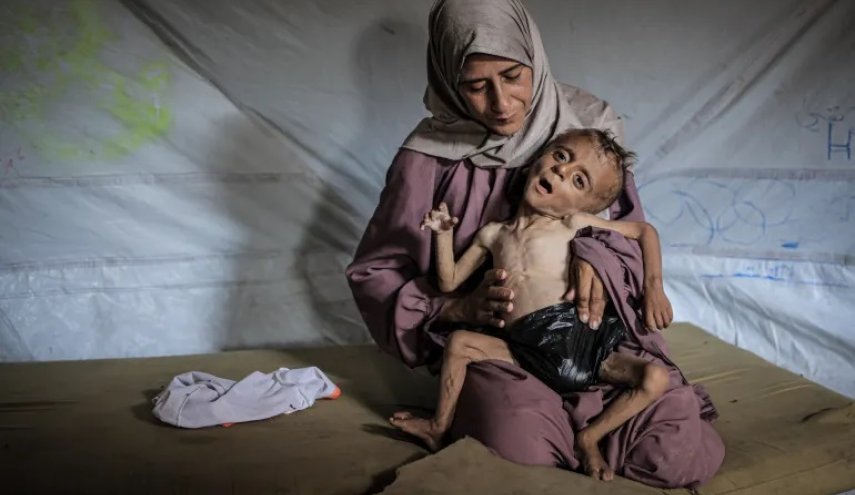 خلال 24 ساعة.. حصيلة ضحايا المجاعة في غزة ترتفع إلى 332 شهيدًا