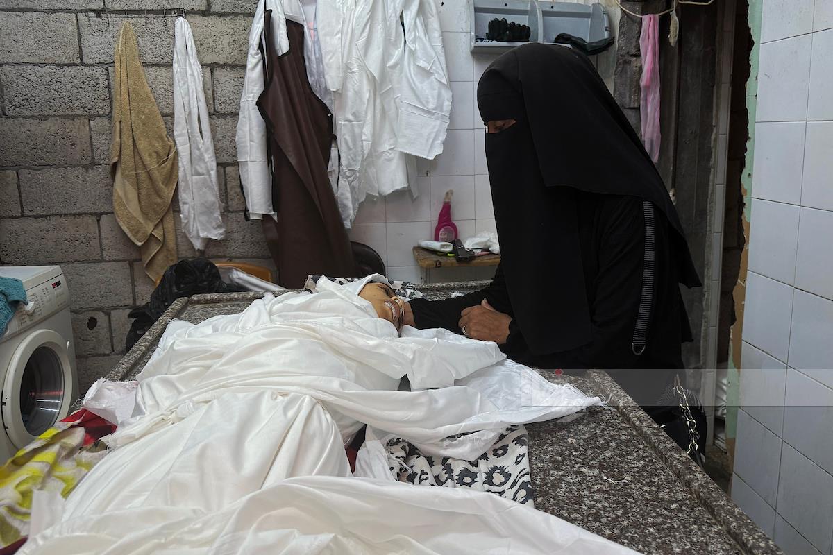 أونروا: ضحايا التجويع في غزة أعلى مما تعلنه وزارة الصحة