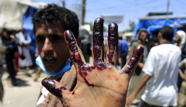 Who Benefits from Yemen&#39;s insecurity?