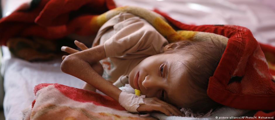 وسط تحذيرات أممية وحقوقيّة.. السعودية ترتكب أكبر مجاعة عالمية في اليمن