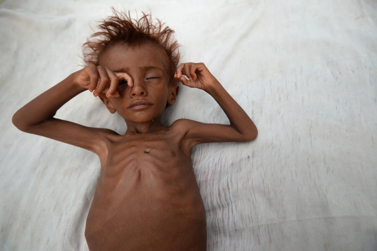 مجلس الأمن يتّهم السعودية بمجاعة اليمن ويدعوها لوقف عدوانها