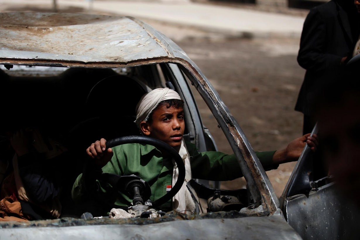 بعد عامين من العدوان..البقاء على قيد الحياة حلم يؤرق أطفال اليمن