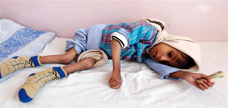 یمن میں زیادہ تر عام شہری جاں بحق ہو رہے ہیں : اقوام متحدہ