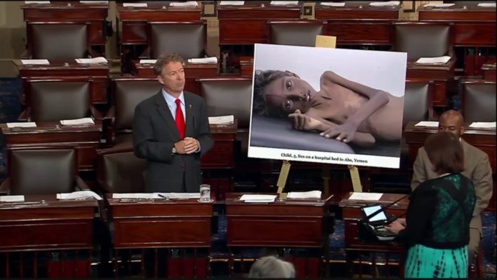 سيناتور أمريكي: مجاعة اليمن سببها السلاح الأمريكي والسعودية