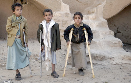 Over 3,600 Yemeni Children, 800 Paralyzed Due to Saudi-Led Aggression: Report