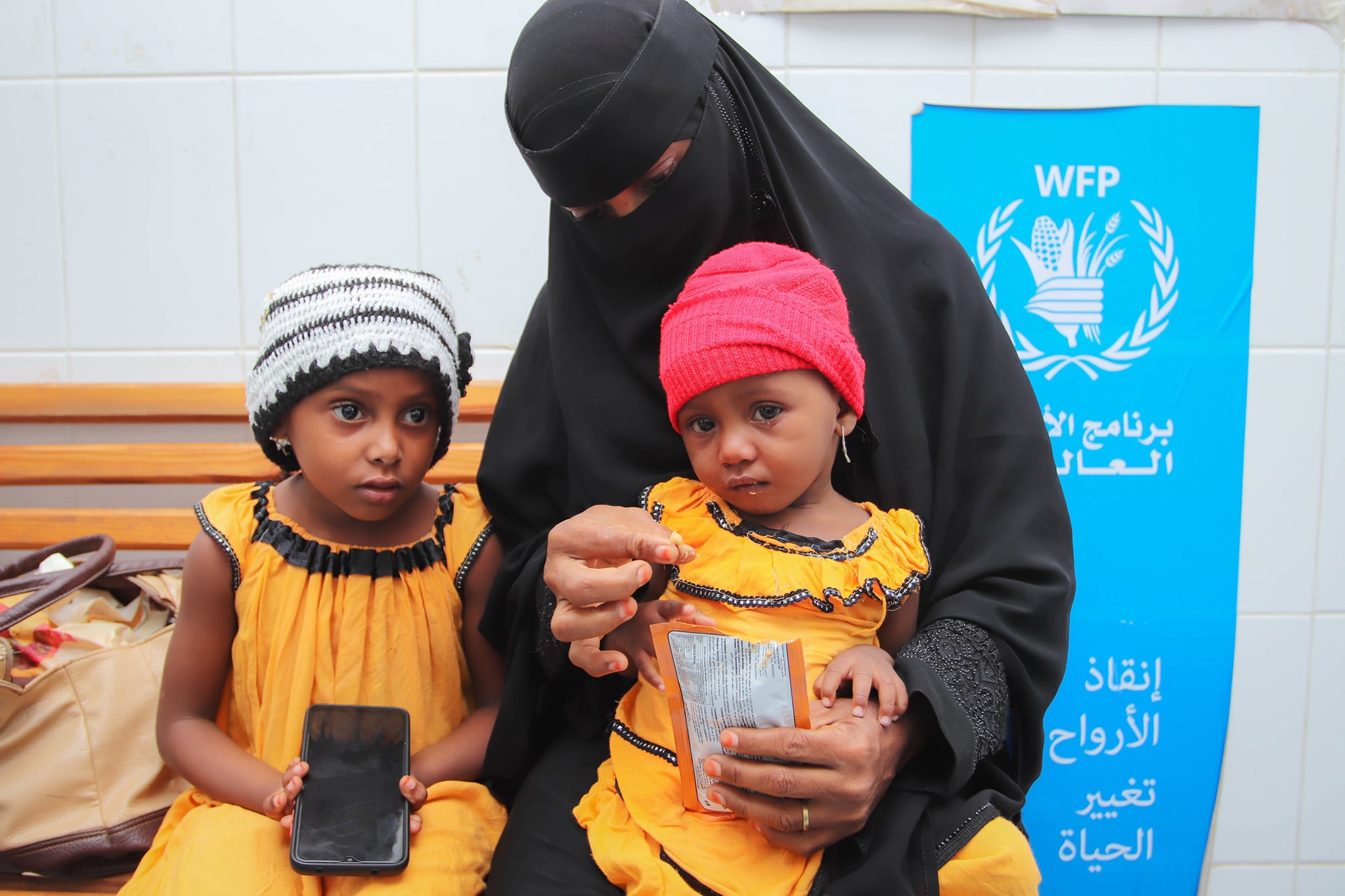 الأطفال اليمنيون يموتون جوعاً.. الأمم المتحدة تحذّر من سوء التغذية الحادّ لأطفال اليمن+ صور