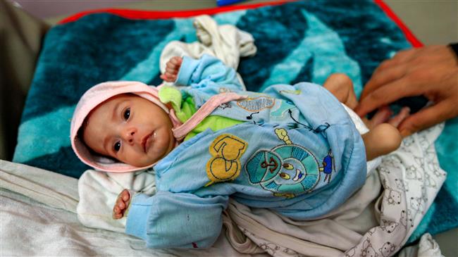 50,000 Children Die Every Year in Yemen