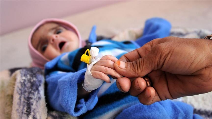 3/4 of Yemeni Kids ‘Chronically Malnourished’: WHO