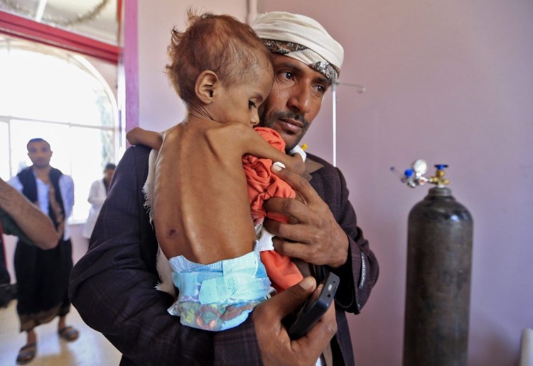 اليمن: الامم المتحدة تتجاهل معاناة اليمنيين عن قصد!