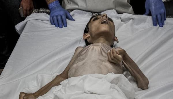 افزایش شمار شهدای سوءتغذیه و گرسنگی در نوار غزه به 37 نفر