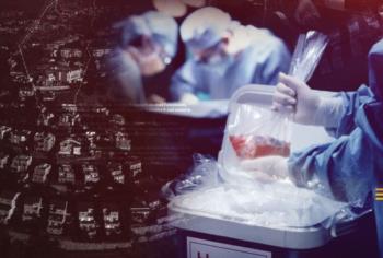 أكبر بنك للجلد البشري في العالم في الكيان الإسرائيلي: انتهاكات محتملة، حقائق علمية، وحدود حرية التعبير